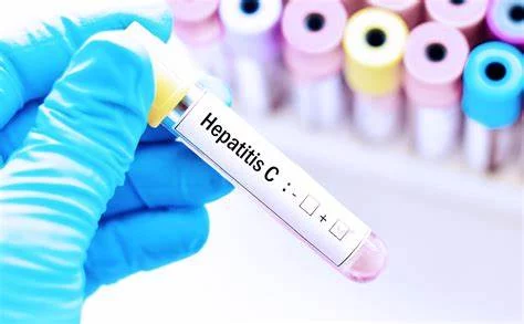 Prevención de la hepatitis C