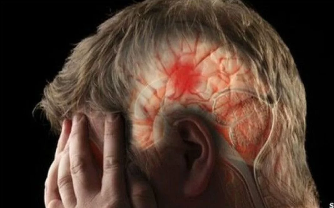 accidente cerebrovascular a Vida.es