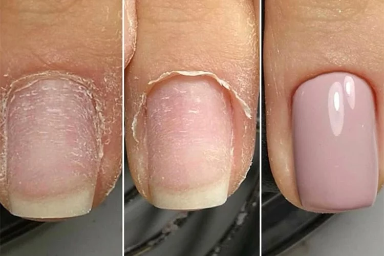 HIGIENE Y ESTERILIZACIÓN: FACTORES CLAVE EN LA MANICURA RUSA